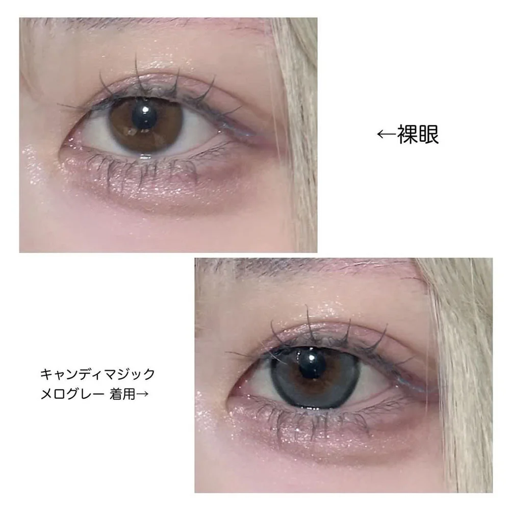 candymagic 1day メログレー